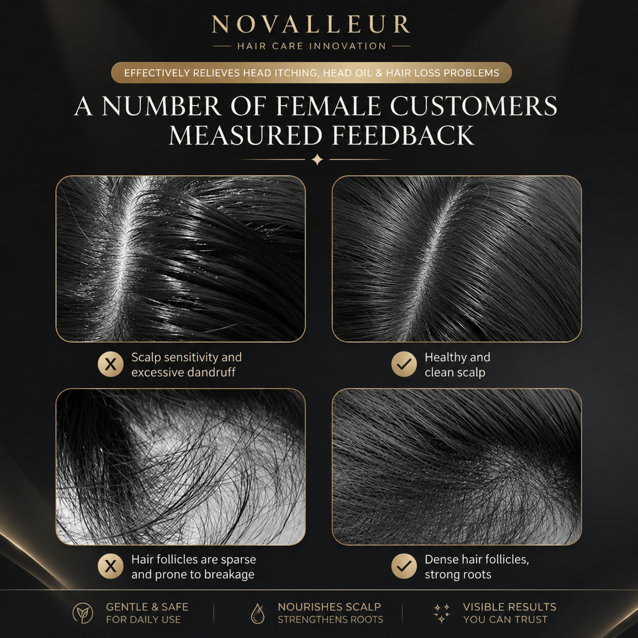 Novalleur™ 3-in-1 Red Light Scalp Massager & Oil Diffuser